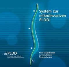 Ưu thế và quy trình thực hiện PLDD